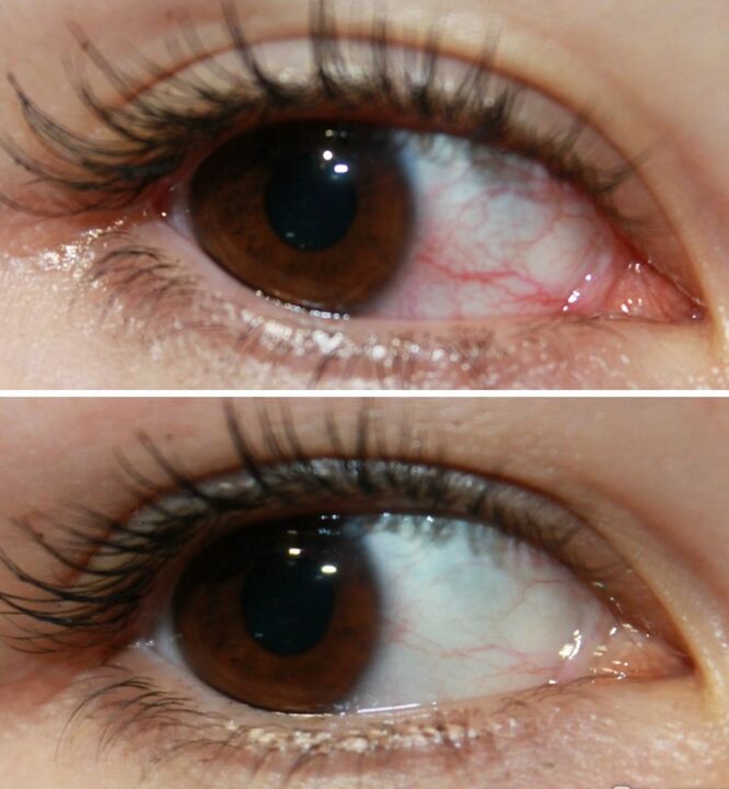 Ocuvit deluje zelo hitro